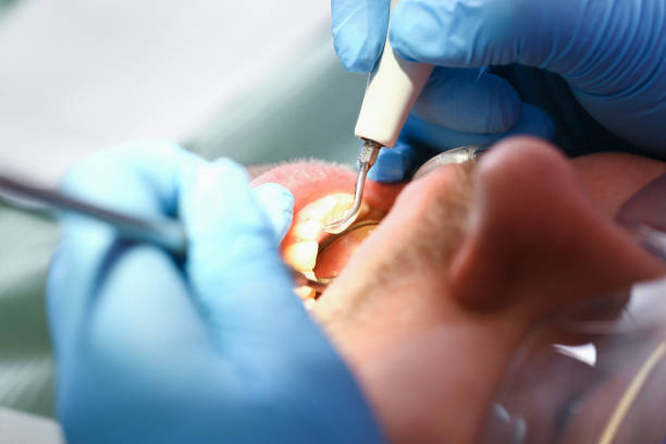 Best Emergency Dental Care for Abscessed Tooth in Berkley, MI