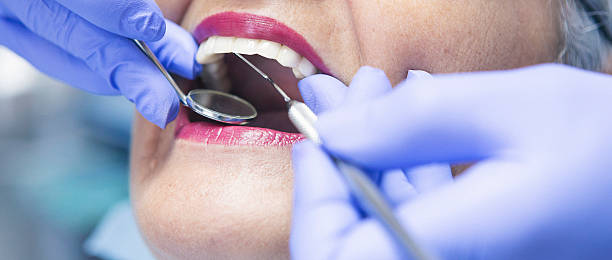 Best Urgent Dental Care for Toothache in Berkley, MI
